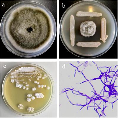 Streptomyces lydicus M01 Regulates Soil Microbial Community and Alleviates Foliar Disease Caused by <mark class="highlighted">Alternaria alternata</mark> on Cucumbers